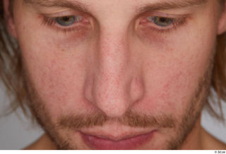 Erling nose 0001.jpg